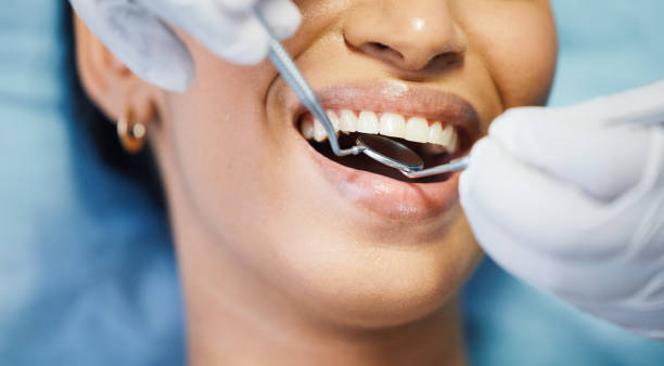 Best Emergency Denture Repair in Missouri Valley, IA
